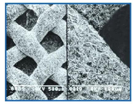 Bracket après sablage 50 µm