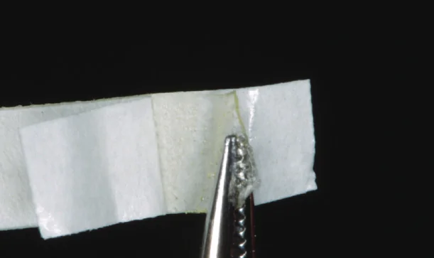 Étape 2