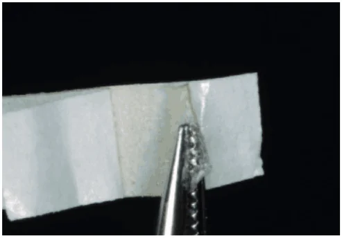 Étape 6