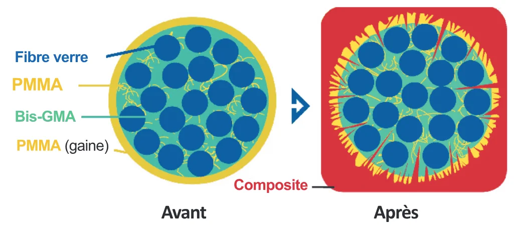 Schéma : fibre de verre, PMMA, Bis-GMA, gaine PMMA, composite – avant / après