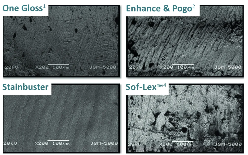 Images au microscope électronique de l’émail après finition